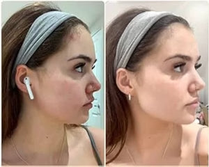 Rechargeable Face Massager