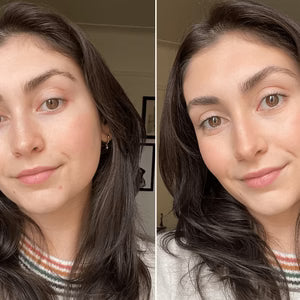 Rechargeable Face Massager